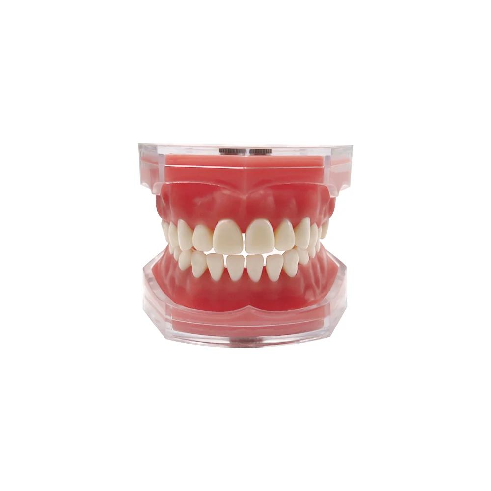 Modello Isolato Dei Denti Della Carie Di Dimostrazione Del Dentista