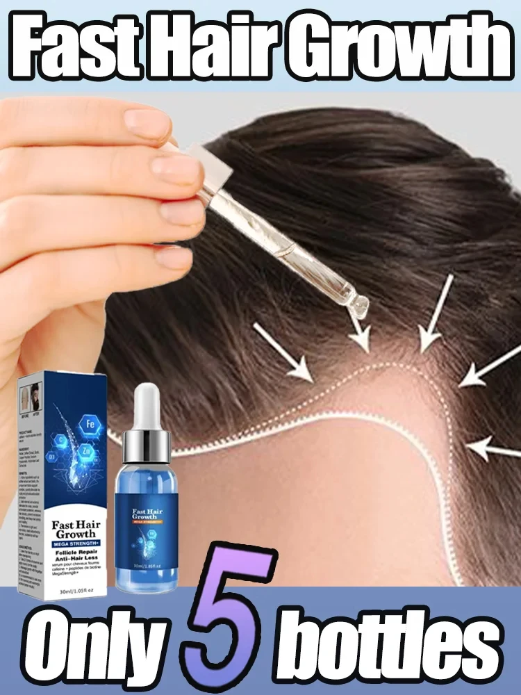 Hair Growth Oil Baldness Repair