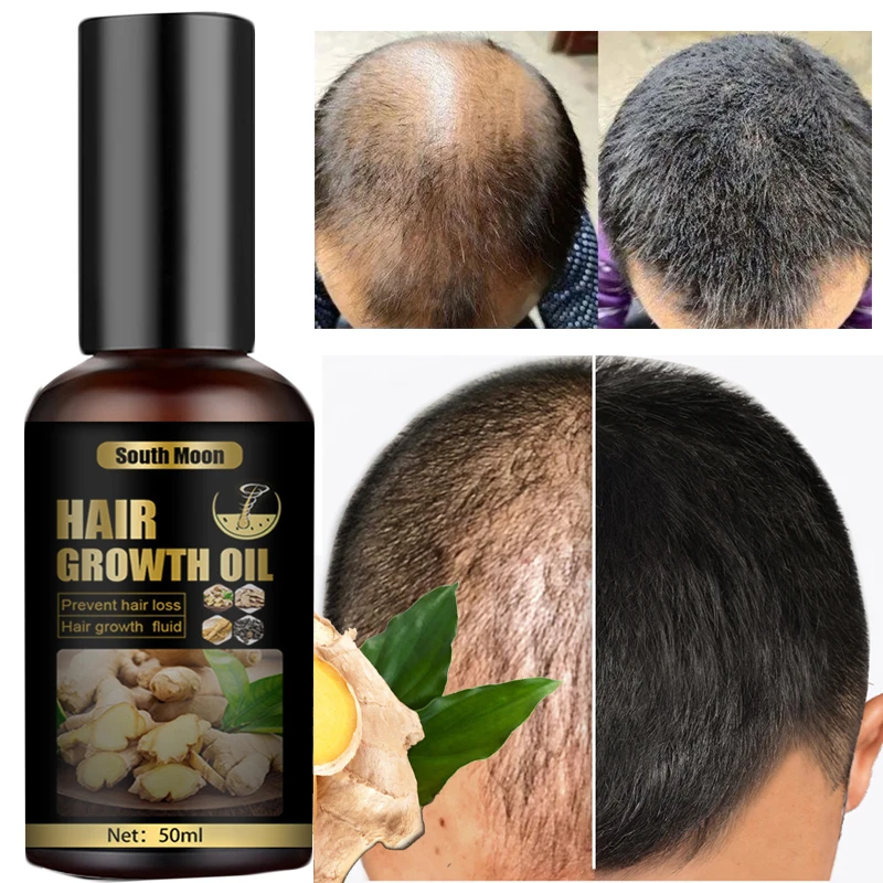 50ml Hair Growth Products Ginger Anti Hair Loss Spray Fast Thickening