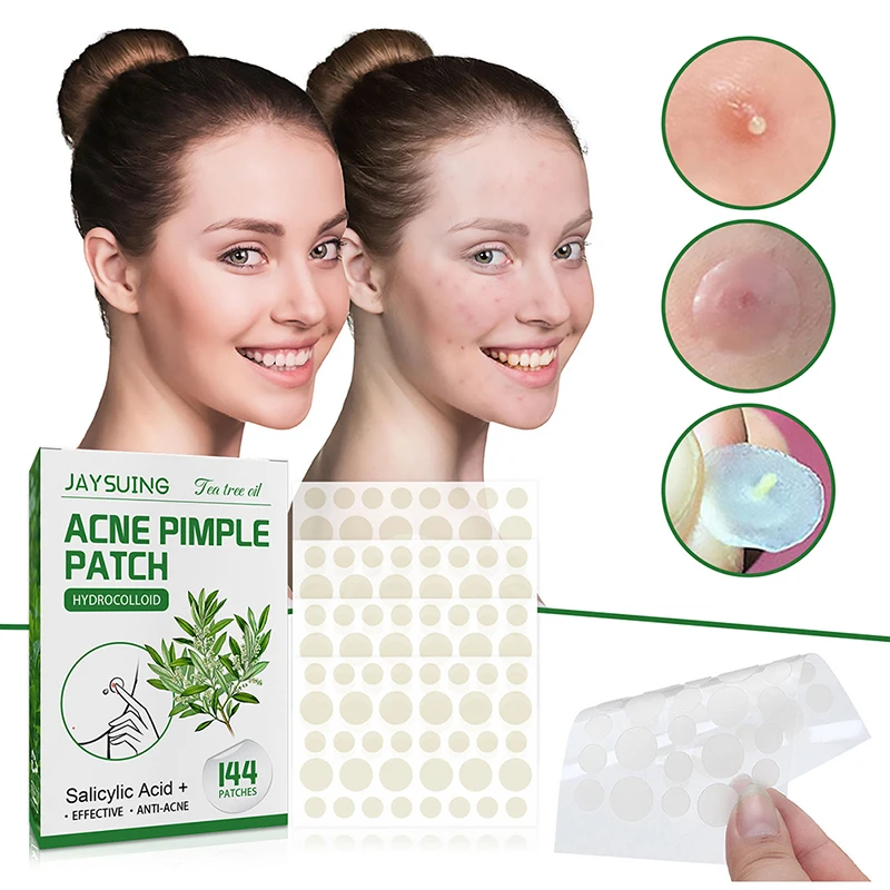 

144 Patches Acne Pimple Patch Face Invisible Stickers Quick Effect Treatment Removing Patches Beauty Acne Tools Face Skin Care