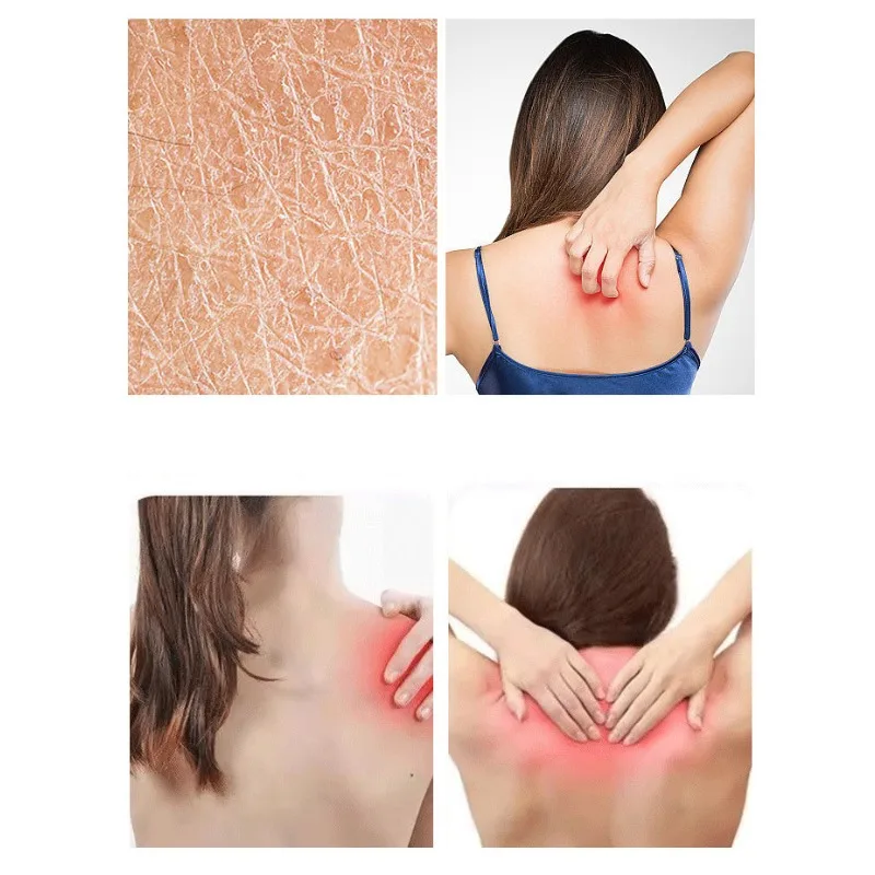 Thailand Tiger Balm Ointment Joint Arthritis Muscle Pain Patch Red Tiger Balm Medicine Body Massage Itch Cream Medical Plaste personal health care pain analgesic cream anti mosquito balm