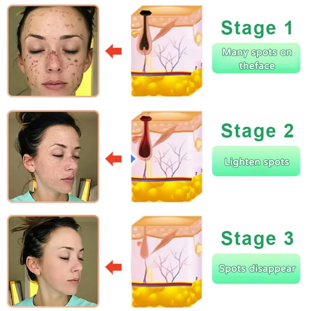 Revitalize Skin Fruit Acid Peeling Gel Facial Cleansing Exfoliating Peeling Scrub Deep Clean Acne Blackhead Remove Face Cleanser facial cleanser