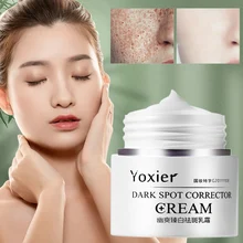 

30g Face Body Cream Dark Spot Corrector Fade Dark Spots Freckles Brighten Skin for Face Arms Legs for Men Women