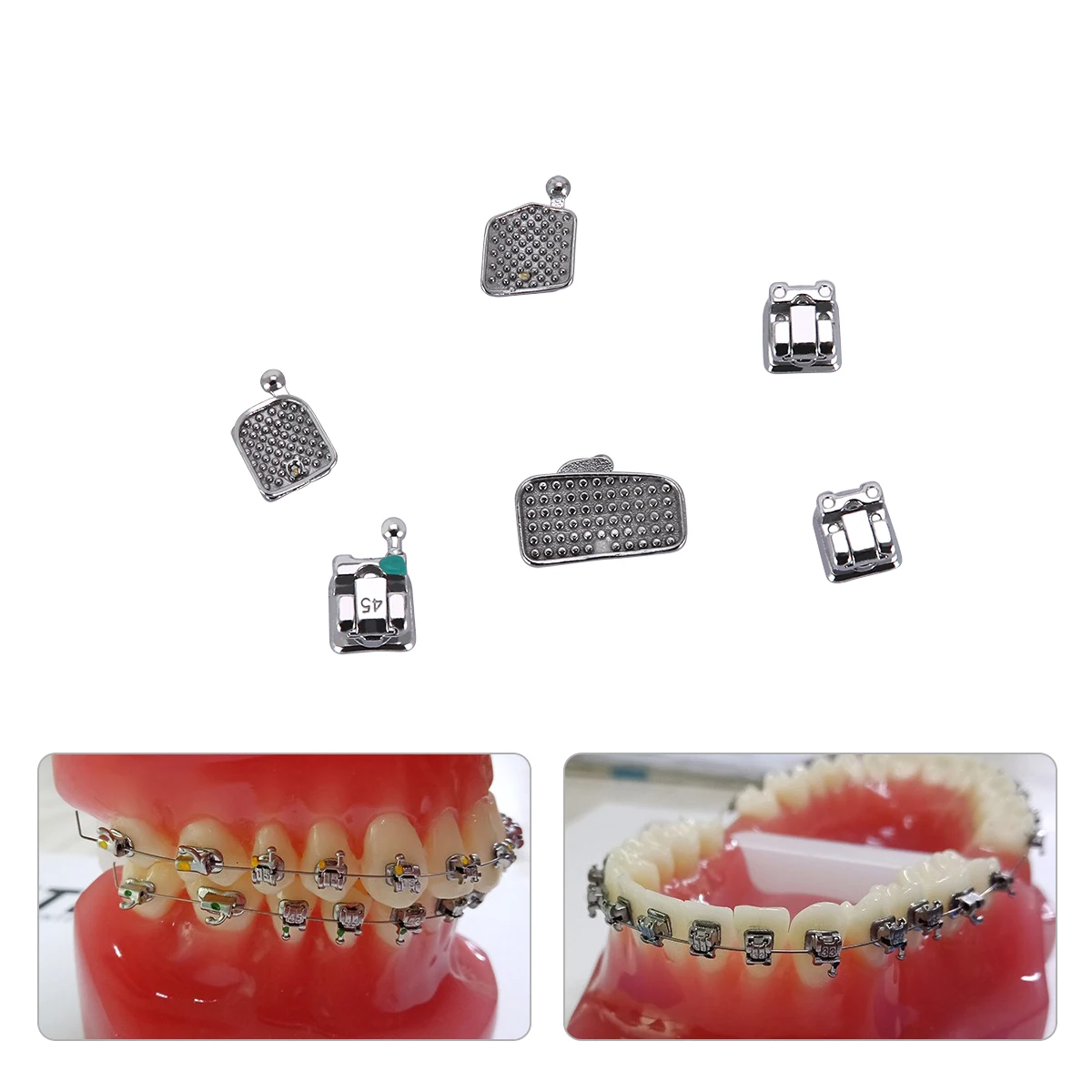 AZDENT Dental Kieferorthopädische Klammern Klammer AZDENT Passive selbstligierende ROTH MBT 0,022 Haken 3 4 5 mit Bukkalröhrchen MIM Monoblock – Detail 8