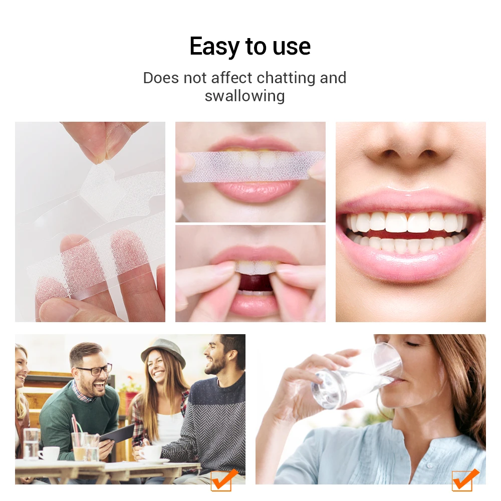 5D Gel teeth whitening strips teeth whitening kit teeth whitening gel for false Teeth Veneers