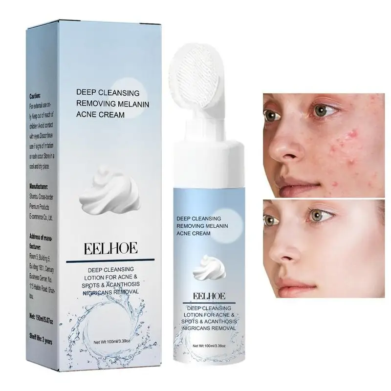 

Gentle Cleanser Tea Tree Balancing Foaming Cleanser With Aloe Oily Skin Facial Cleansing Pore Cleaner Natural Hydrating Face