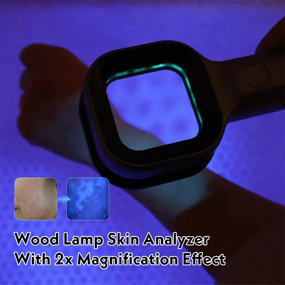 Veterinary Woodard Lamp 365nm UVA LED Light Source Pet Medical Wood lamp For Pet