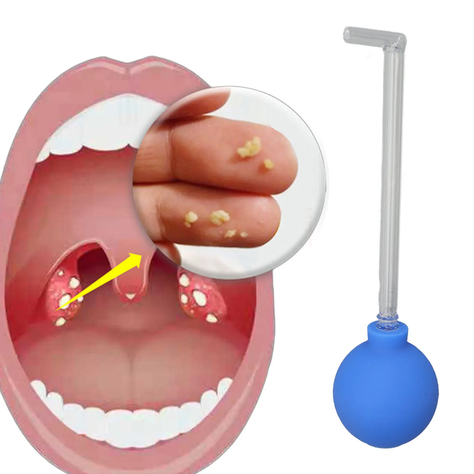 Tonsil Stone Remover Tonsil Stone Removal Tool Right Angle PVC Suction Ball Reduce Bad Breath Throat Suction Tube Mouth Cleaner 4