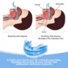 Adjustable Anti Snoring Mouth Guard Anti-Snoring Mouthpiece Sleeping Devices Bruxism Snoring Stopper Improve Sleep Mouthpiece 3