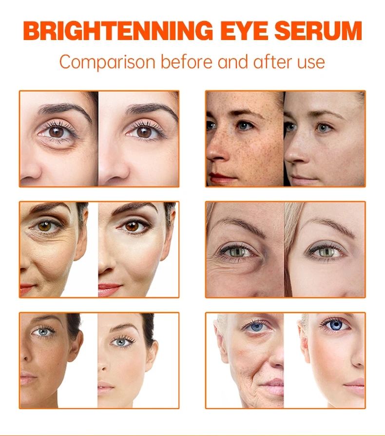 Sérum Anti-âge Anti-rides pour le visage, resserrement du visage, réduit les ridules des yeux, hydratant, sérum blanchissant pour les taches de rousseur_voghion.com