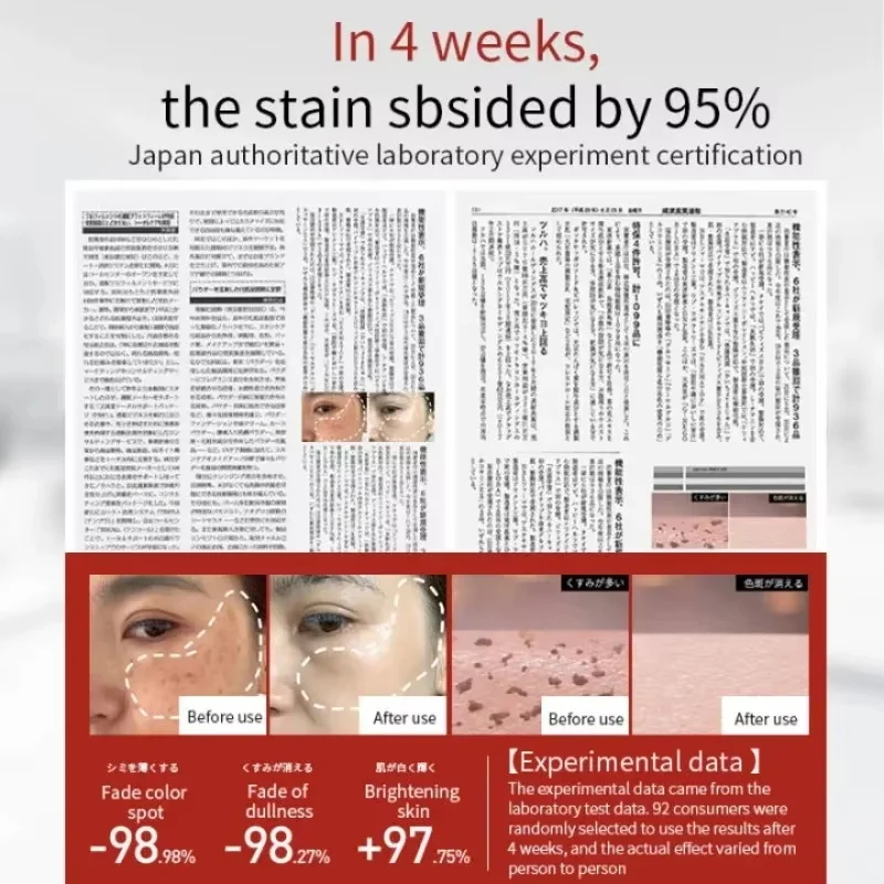 Facial Cream Whitening Freckles Removal Melasma Dark Spots Corrector Lighten Melanin Pigmentation Brighten Anti-Aging