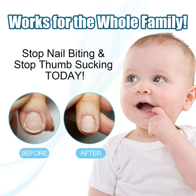 Share 152+ nail biting baby super hot songngunhatanh.edu.vn