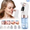 Electric Blackhead Remover Vacuum Facial Pore Cleaner Rechargeable Deep Dirt Skin Cleaning Machine for Pimple Blackhead Removal 1