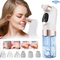 Electric Blackhead Remover Vacuum Facial Pore Cleaner Rechargeable Deep Dirt Skin Cleaning Machine for Pimple Blackhead Removal 1