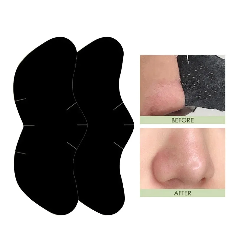 Blackhead  Nose  Patch  for  Deep  Cleansing  -  Quickly  Removes  Blackheads  &  Facial Spots ,  Restores  Fresh  Skin