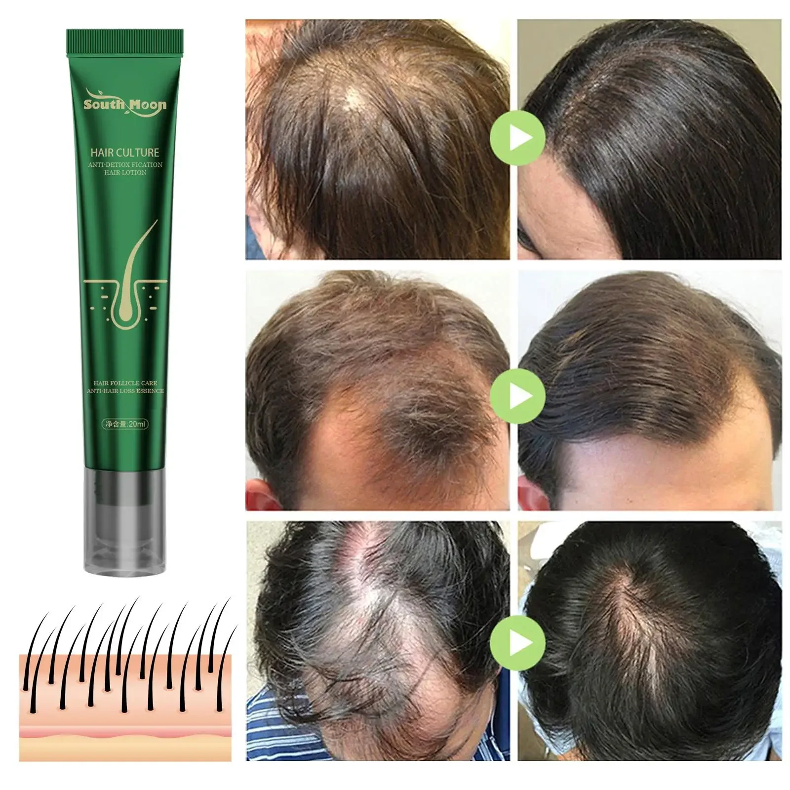 10PCS Biotin Fast Oil Hair Growth Serum Hair Thinning Treatment Liquid Anti-Hair Loss For Women & Men