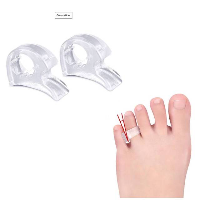 Big Bone Toe Straightener Separator Bunion Splint Foot Hallux Valgus Corrector Splint Foot Pain Relief Foot Care Tool