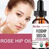 5ML/15ML/30ML/50ML/Pure Essential Oils Rosehip Oil Moisturizing Brighten Skin Color Essential Oil Anti-Dry Anti-Aging Face Essen 3