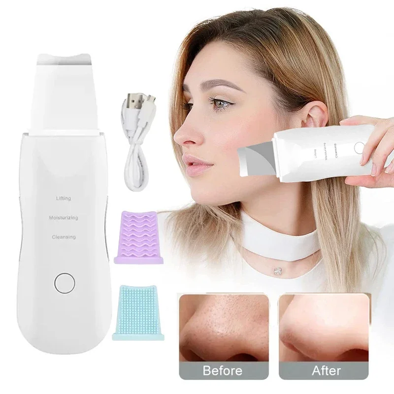 Ultrasonic Facial Scrubber