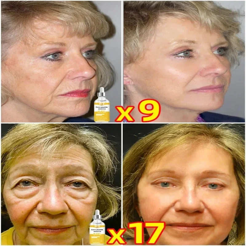 Revitalize your skin with our Anti-Aging Serum Neck Wrinkle Remover 5