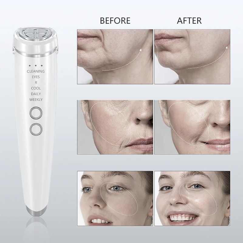 6-IN-1 EMS Facial Massager USB Rechargeable, Hot & Cold Therapy for Face, Eyes & Neck-Beauty Instrument Perfect Gift for Women