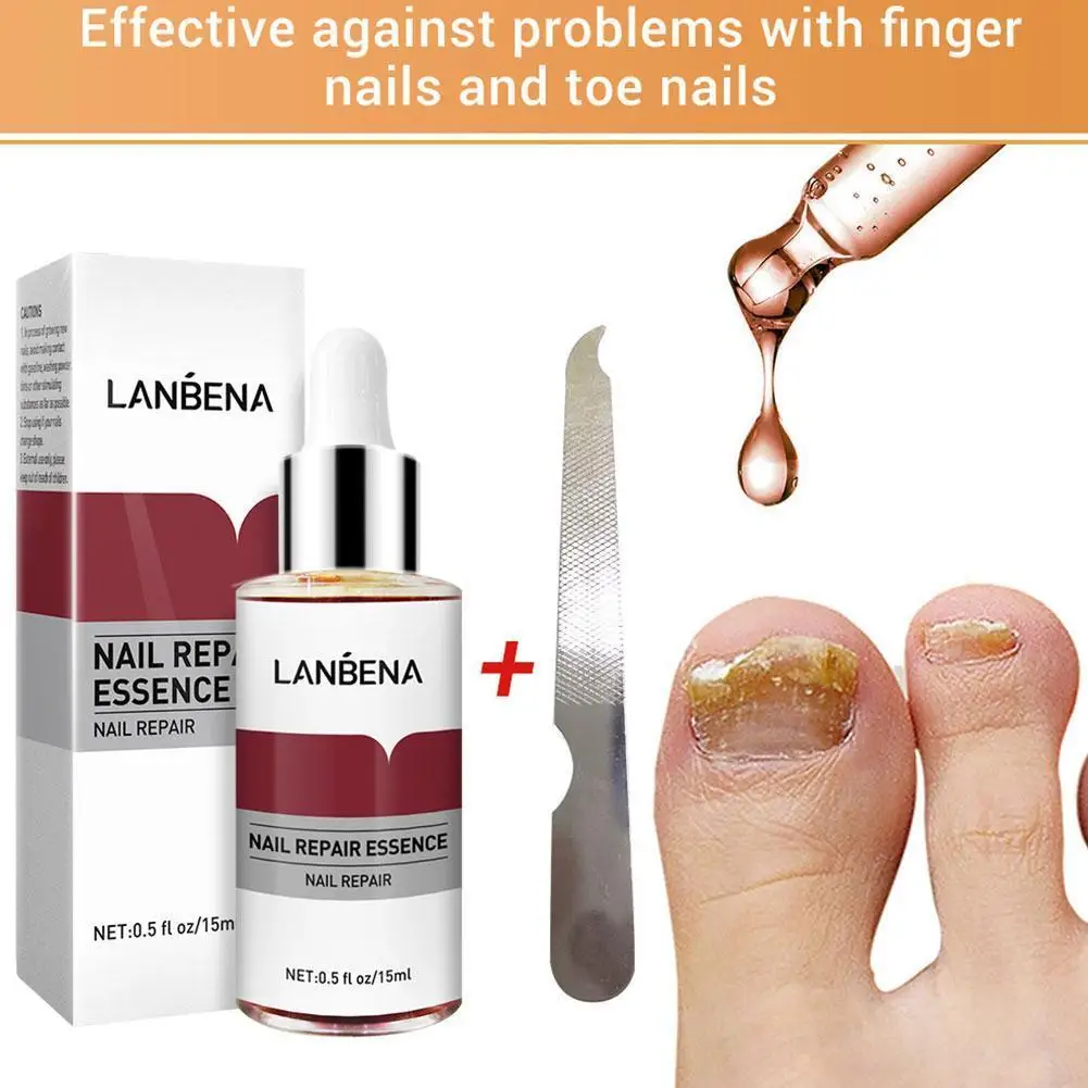 

15ml LANBENA Fungal Nail Treatment Feet Care Essence Removal Serum Paronychia Healthy Infection Onychomycosis Repair Fungus