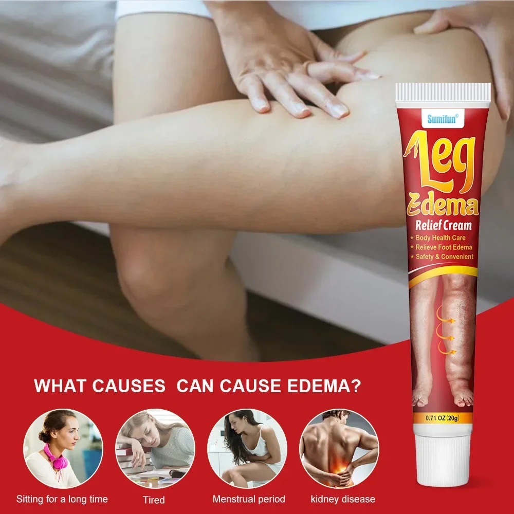 20g Leg Relief Cream For Circulation Relieve Foot Edema Massage Cream For Swollen Legs And Ankles Body Health Care personal health care,pain analgesic cream