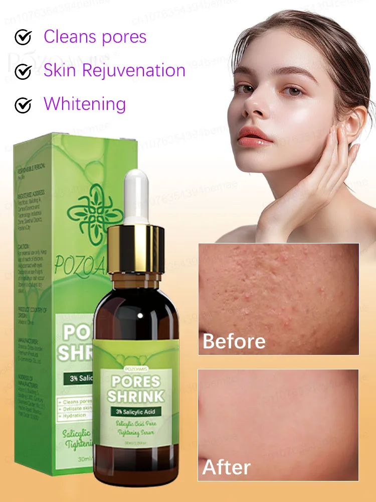 Plant extract facial pore essence Improves large pores Whitens and brightens skin Moisturizes skin