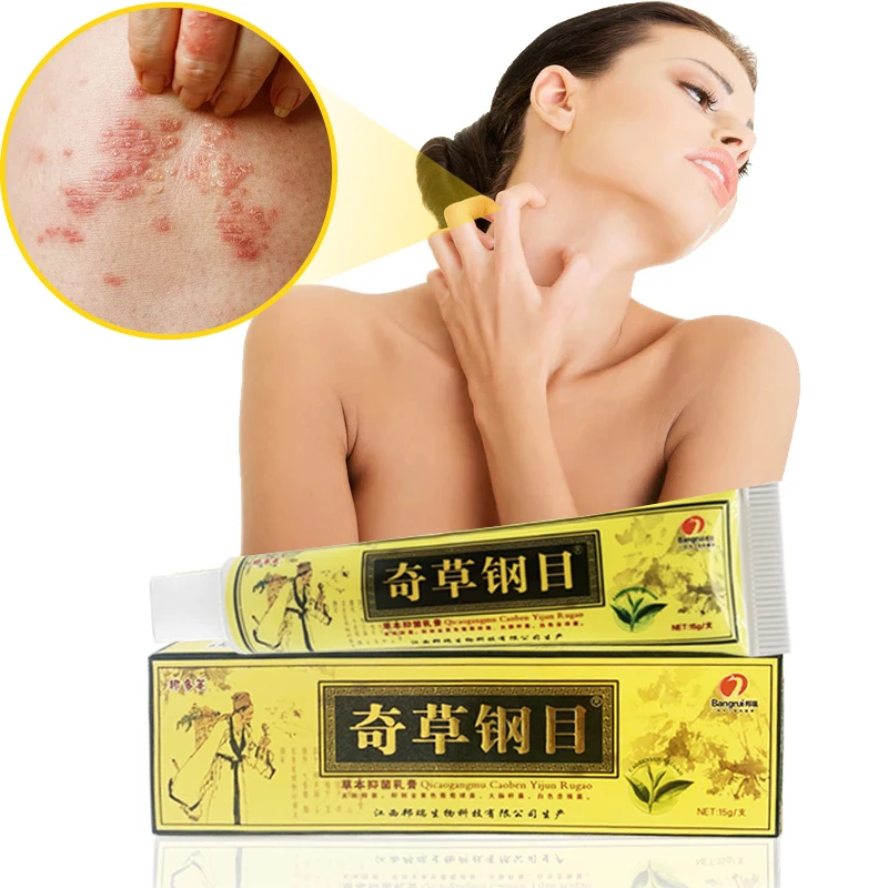 15g Natural Psoriasis Ointment Dermatitis Eczema Treat Antipruritic Cream Eczematoid Skin Urticaria Care Antibacterial Dressing psoriasis treatment cream varicose vein ointment