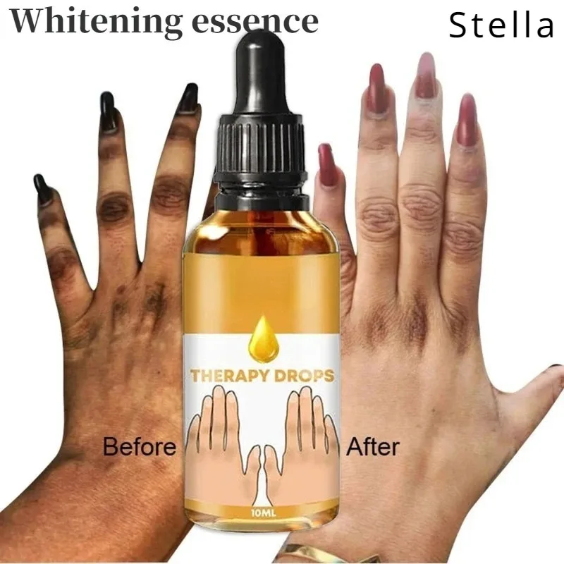 Dark Knuckle Whitening Serum for Quick Fading of Skin Melanin Finger Joints Elbow Knees Intense Cleansing Stain Removal Serum