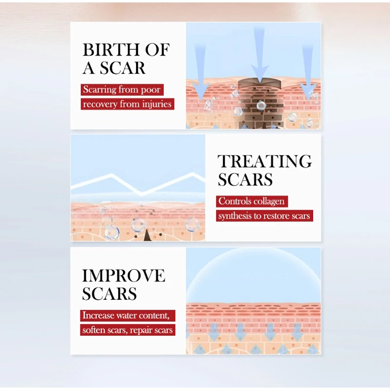 Scar Repair Cream - Moisturizing Rejuvenating Facial Skin Care for Women