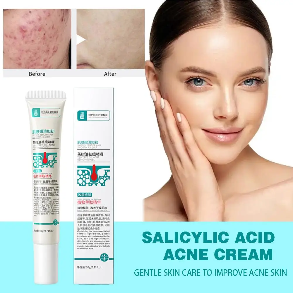 

20g Tea Tree Oil Acne Cream Reduce Acne Pimples To Skin Control Skin Balance Buttocks Keep Delicate Anti-Inflammatory Moist D3R2