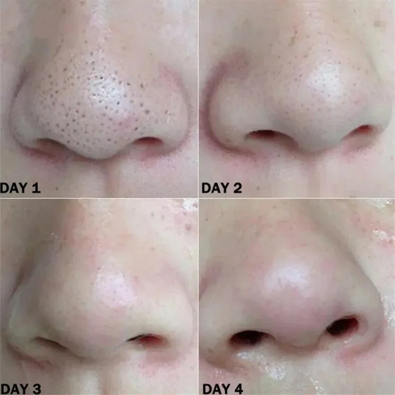 Nose Blackhead Remover Strips Deep Cleansing Pore Strips