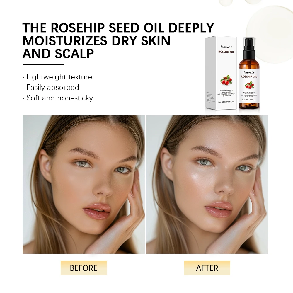 Organic Rosehip Oil Rose Hips Face Oils 30ml Fast-Absorbing Skin Care Moisturizer Face Oil Organic Rosehip Seed Essence facial essence lifting oil