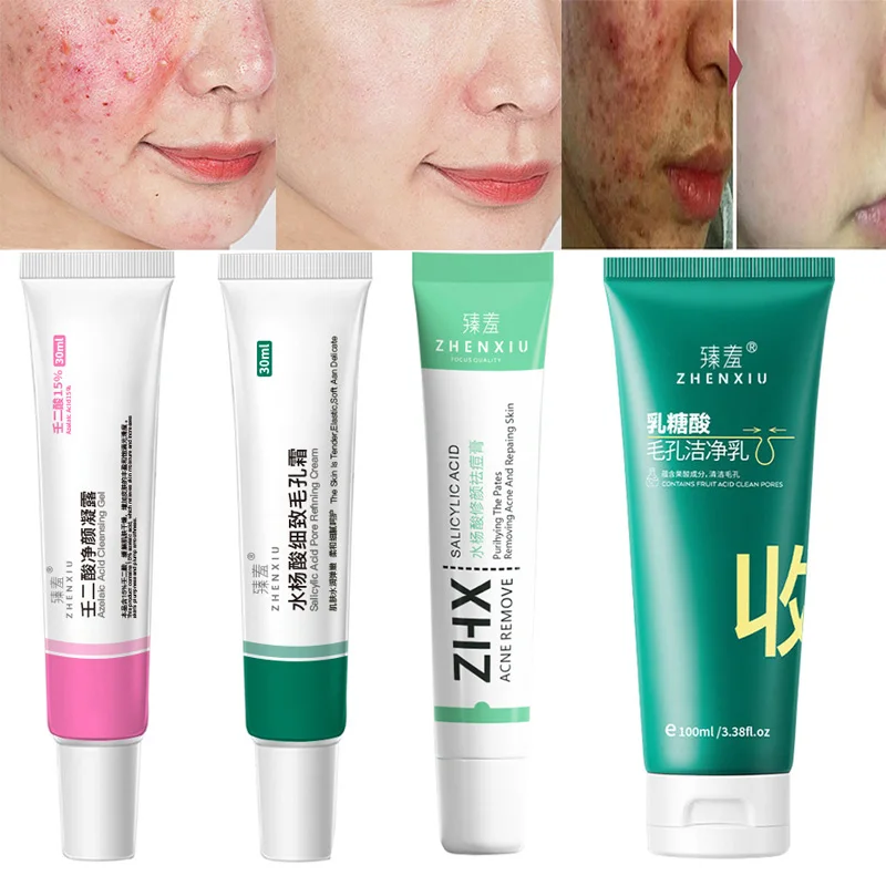 Salicylic Acid Acne Cream Remove Blackhead Oil Control AntiAcne Treatment Repair Pimple Acne