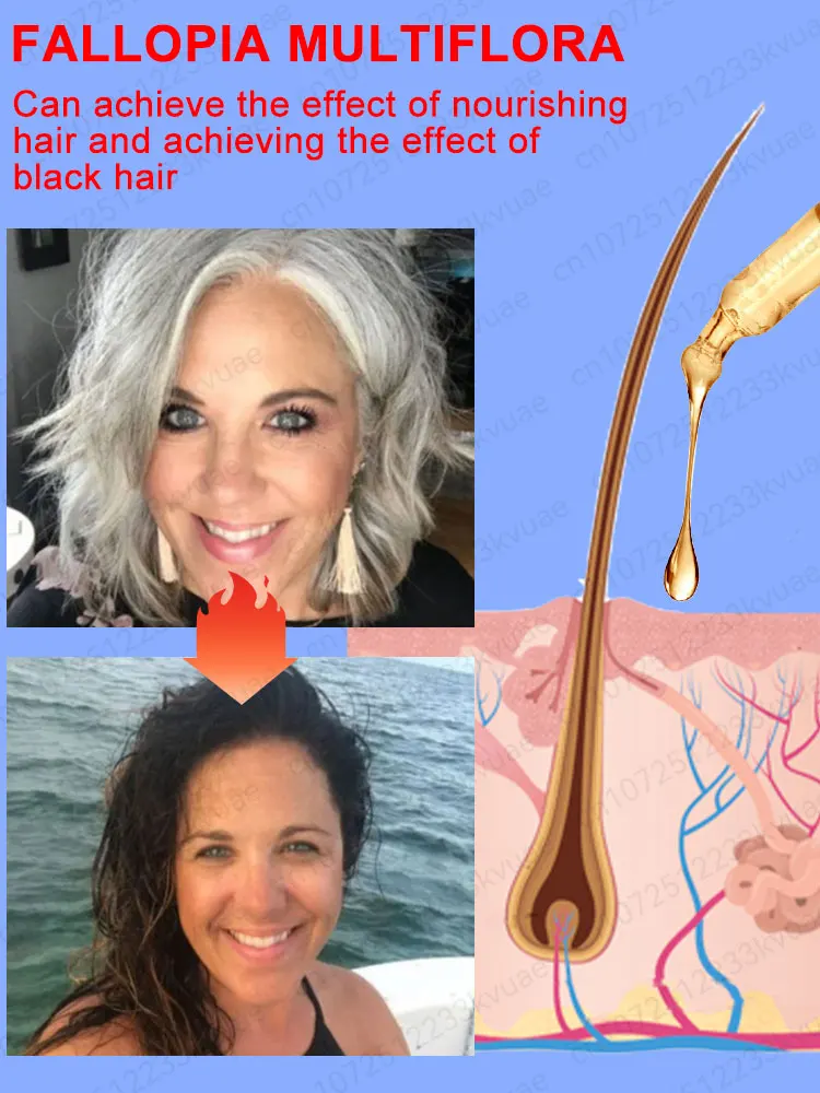 White hair killer remove gray hair restore natural color 7 days hair color restorer