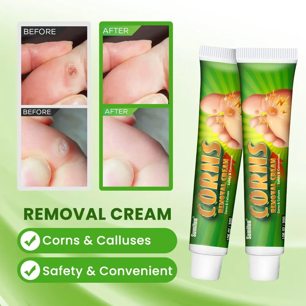 Description Picture 5 of itemFoot Corn Remover Cream Chicken Eye Skin Infection Treatment Ointment Feet Dead Skin Calluses Removal Tool Health Care 발톱무좀