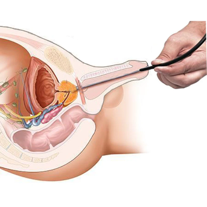 Xotin tortta jinsiy aloqani almashtiradi