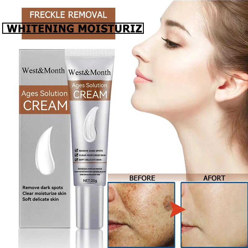 Remove-Freckle-Cream-Whitening-Dark-Spots-Effective-Remove-Melasma