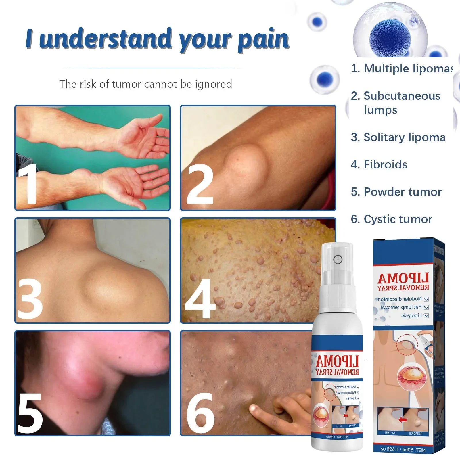 Fat knot Spray Relieves Body Lump Subcutaneous Nodule Dredging Spray Anti Tumor Mitigation Skin Swelling Pain Painless Treatment