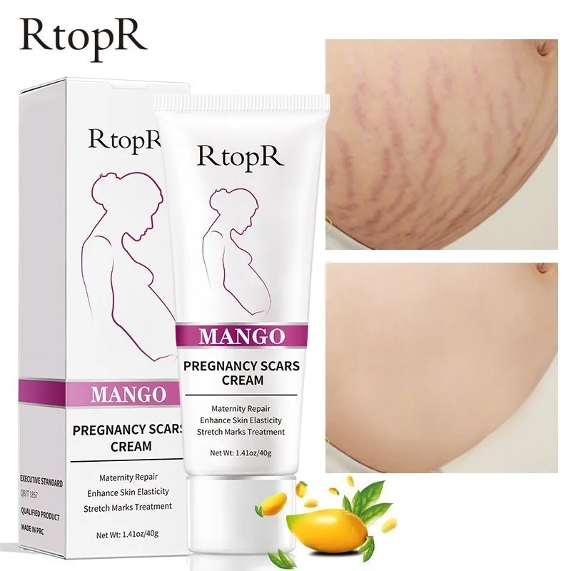 Remove Pregnancy Scars Acne Cream Maternity Stretch Marks Repair Skin Care Effective Anti Wrinkles Firming Beauty Health Creams Stretch Marks Cream