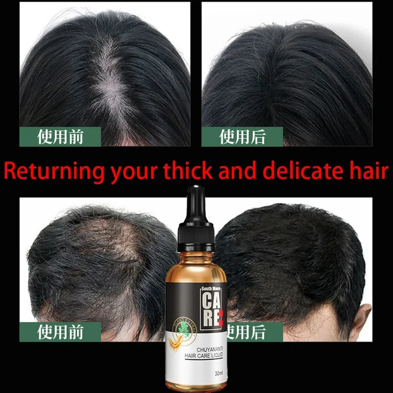 

Anti hair loss and hair growth liquid for hair growth, dense hair, and hair fixing herbal plant extract hair essence