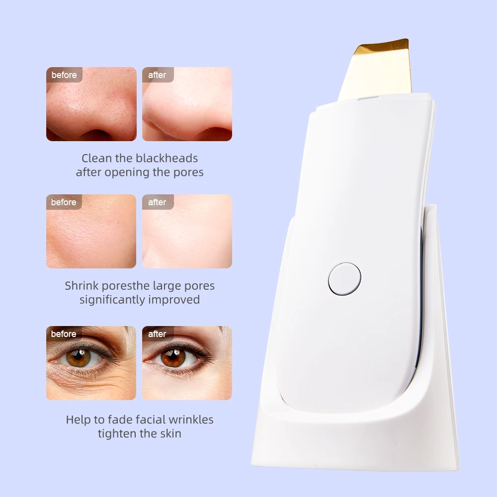 LESEN Ultrasonic washing machine Scrubber Face Cleaning Peeling Shovel Facial Pore Cleaner Blackhead Removal Cuticle removal