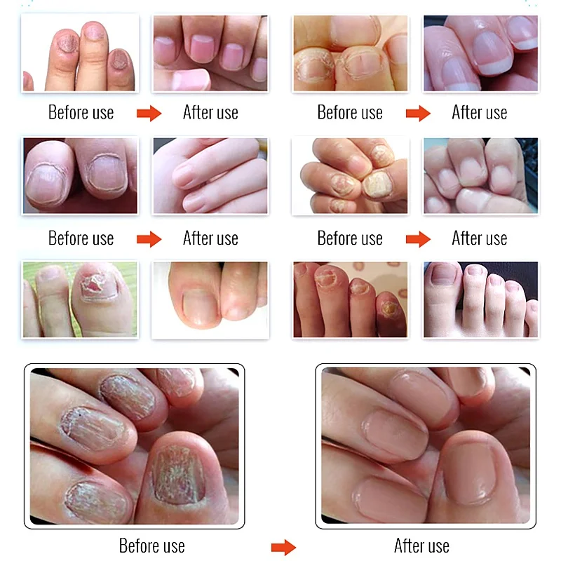 Nail Repair Serum Cozzi