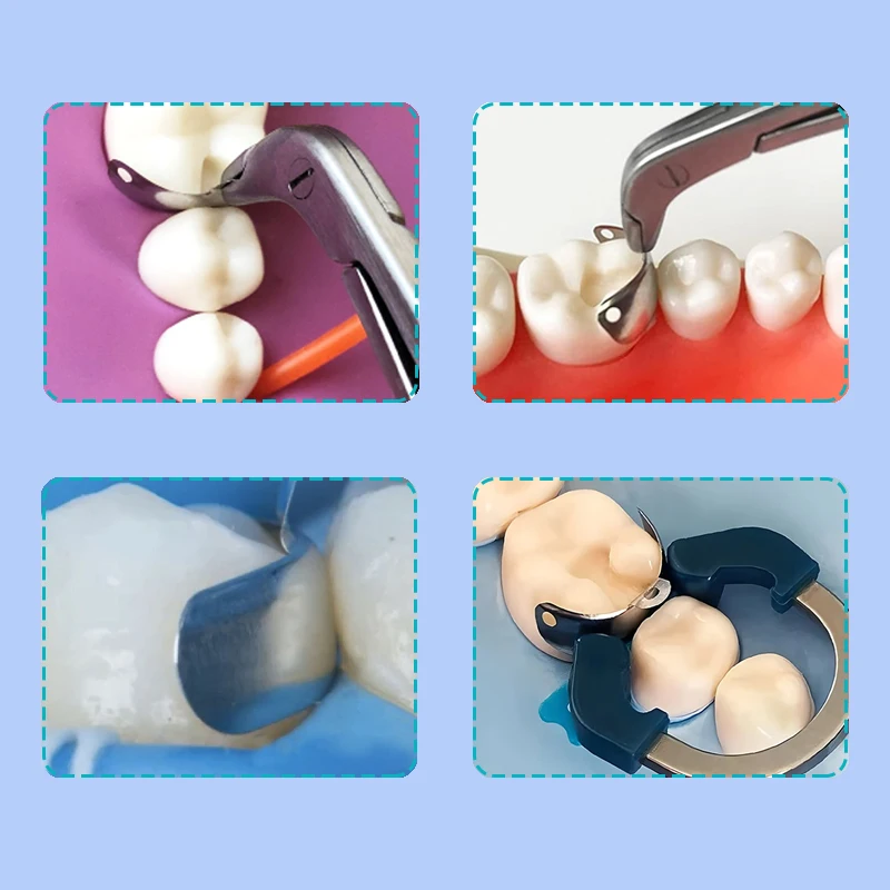 Dental Matrix Bands R7 NITI Matrix Clamp Sectional Contoured Matrix System Metall Matrizen Nickel Titan Klemmring Zahnarzt – Detail 6