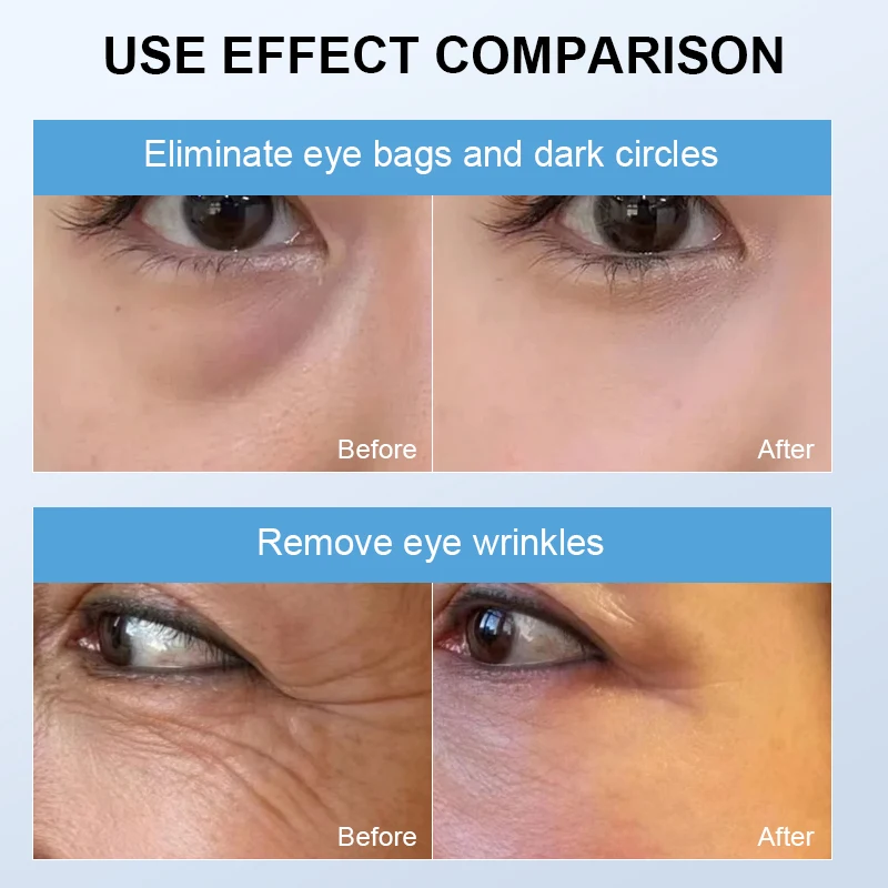 Eye Massager Constant Temperature Heating Vibration Massage Lighten Dark Circles and Eyes Bags Eye Skin Care 3