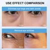 Eye Massager Constant Temperature Heating Vibration Massage Lighten Dark Circles and Eyes Bags Eye Skin Care 3