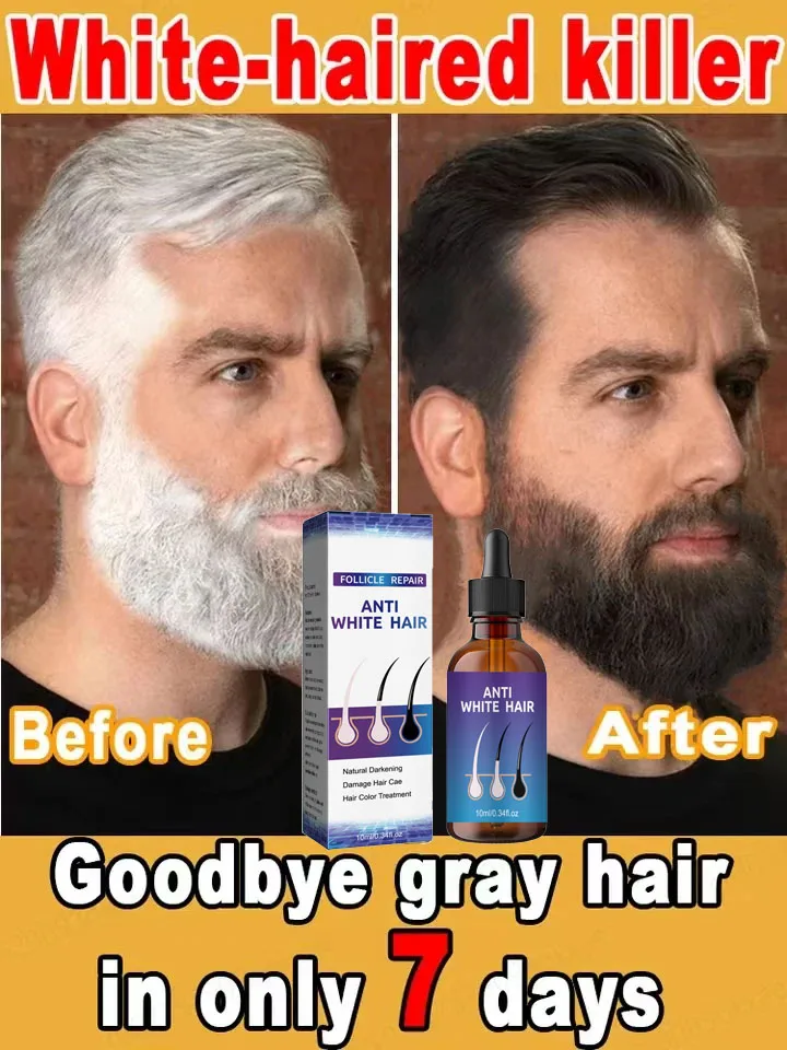 Hair Treatment Oil Natural Anti Gray Hair Serum Nourishing Hair Care Remedy-Repair White & Darkening