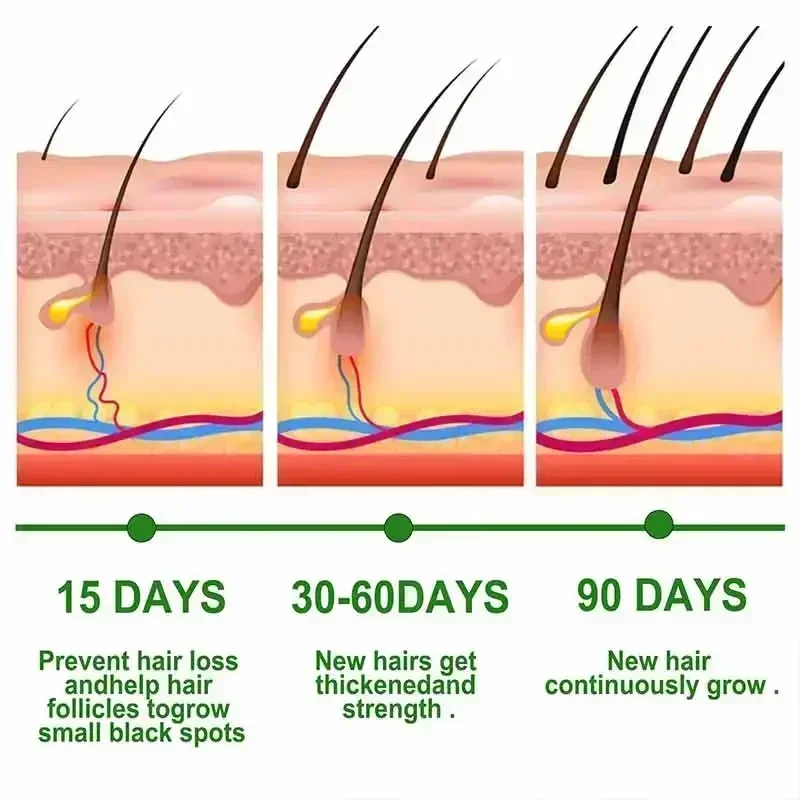 More hair say goodbye to baldness hair becomes thicker authoritative organization scientifically