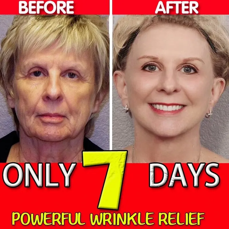

Retinol Wrinkle Remover Face Serum Anti-Aging Fade Fine Line Lifting Firming Moisturizing Essence Whitening Brighten Repair Skin